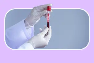 ﺗﺠﻮﯾﺰ آزﻣﺎﯾﺶ ﻫﺎی ﺧﻮن