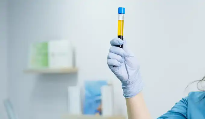 ﭘﻼﺳﻤﺎﺗﺮاﭘﯽ واژن در شریعتی تهران【بهترین دکتر】| کلینیک سپیدا