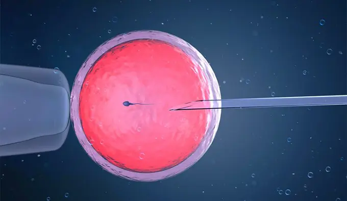 آی ﯾﻮ آی (IUI) کلینیک درمانی سپیدا